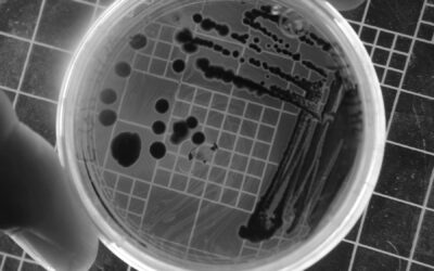 Fungal infections are growing deadlier — and our treatments are running out